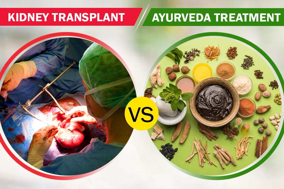 How kidney transplant and Ayurveda treatment is different in nature?