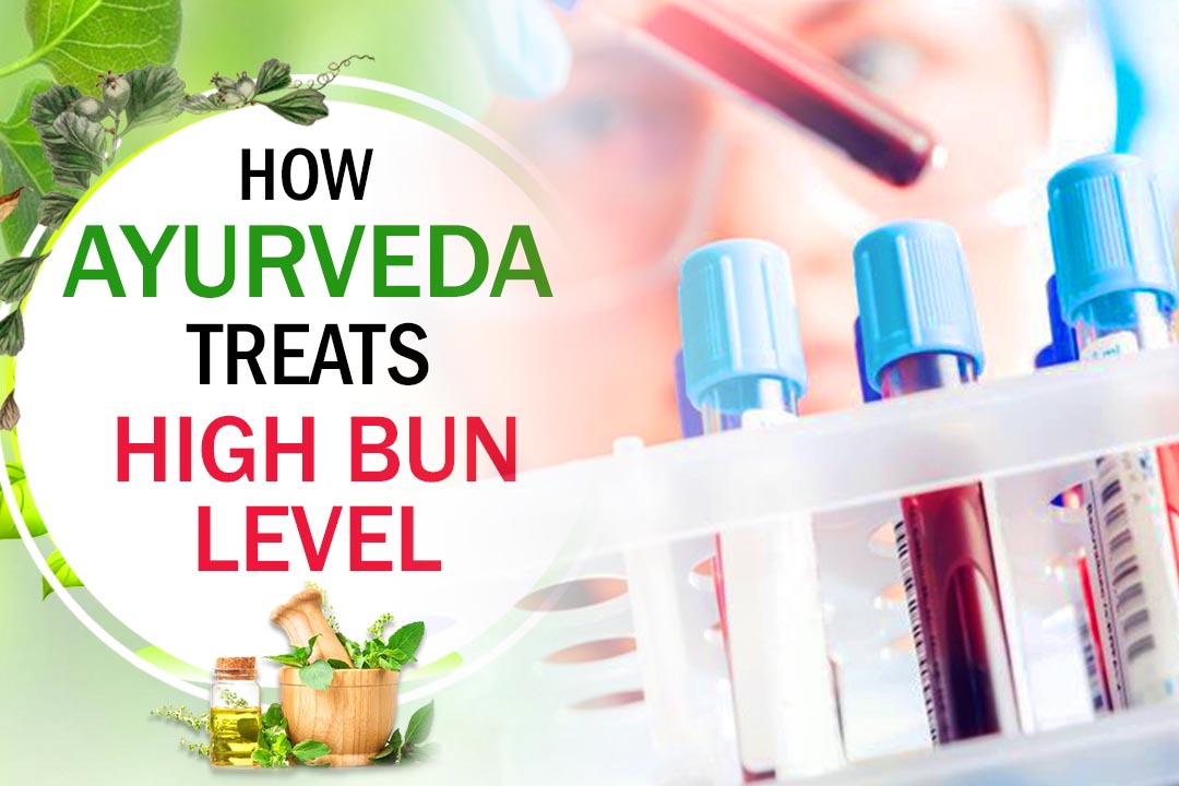 Ayurvedic Medicine & treatment for High BUN Level