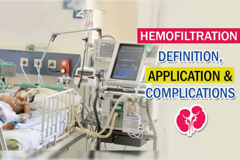 Hemofiltration – Definition, Application & complications!