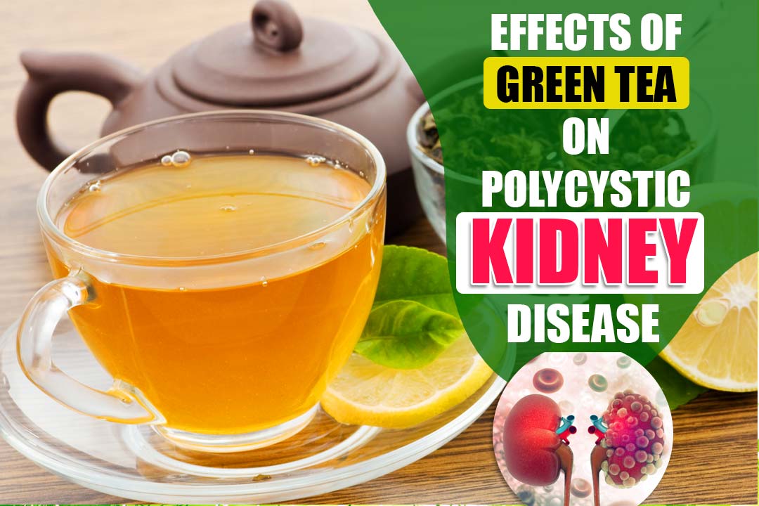 Effects of green tea on polycystic kidney disease Patients