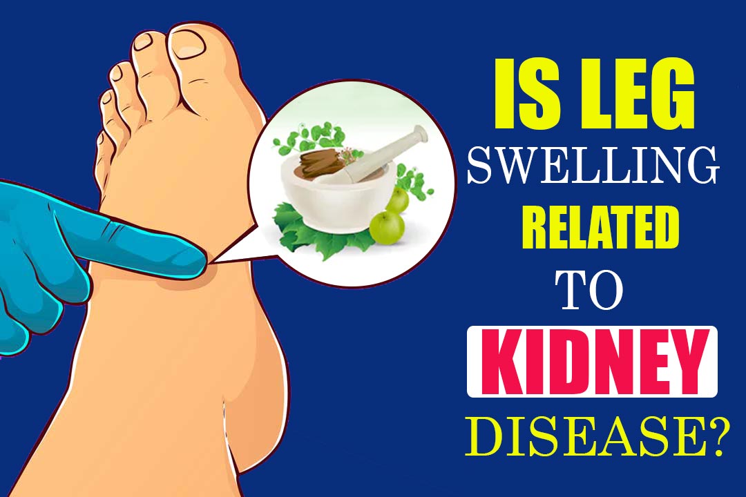 Leg swelling kidney disease by Ayurveda