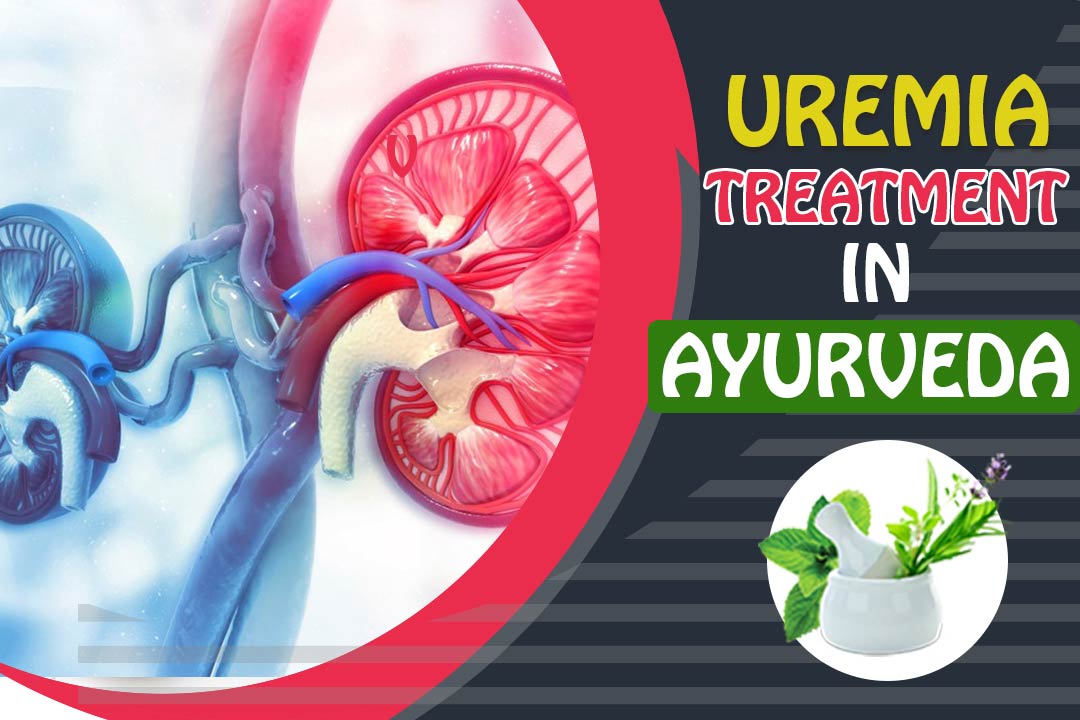 Uremia - Symptoms, Diagnose, Causes & Treatment in Ayurveda