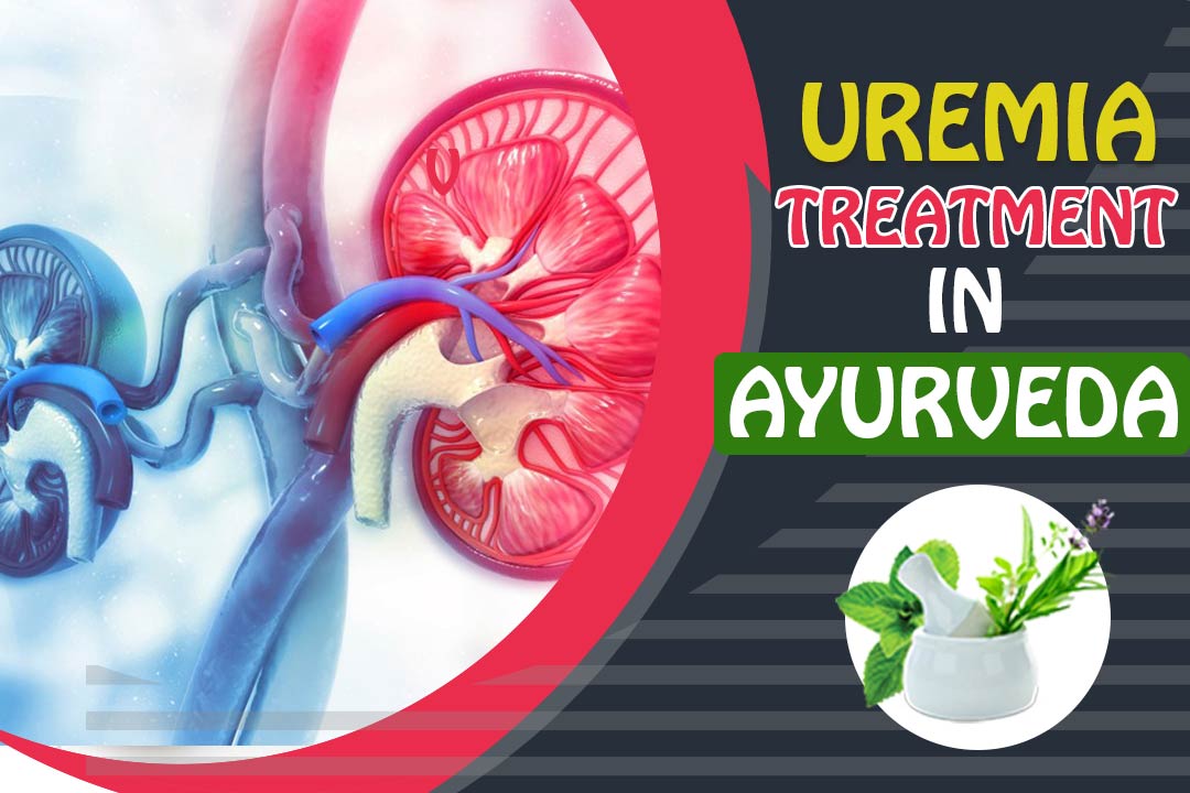 Uremia Treatment in Ayurveda