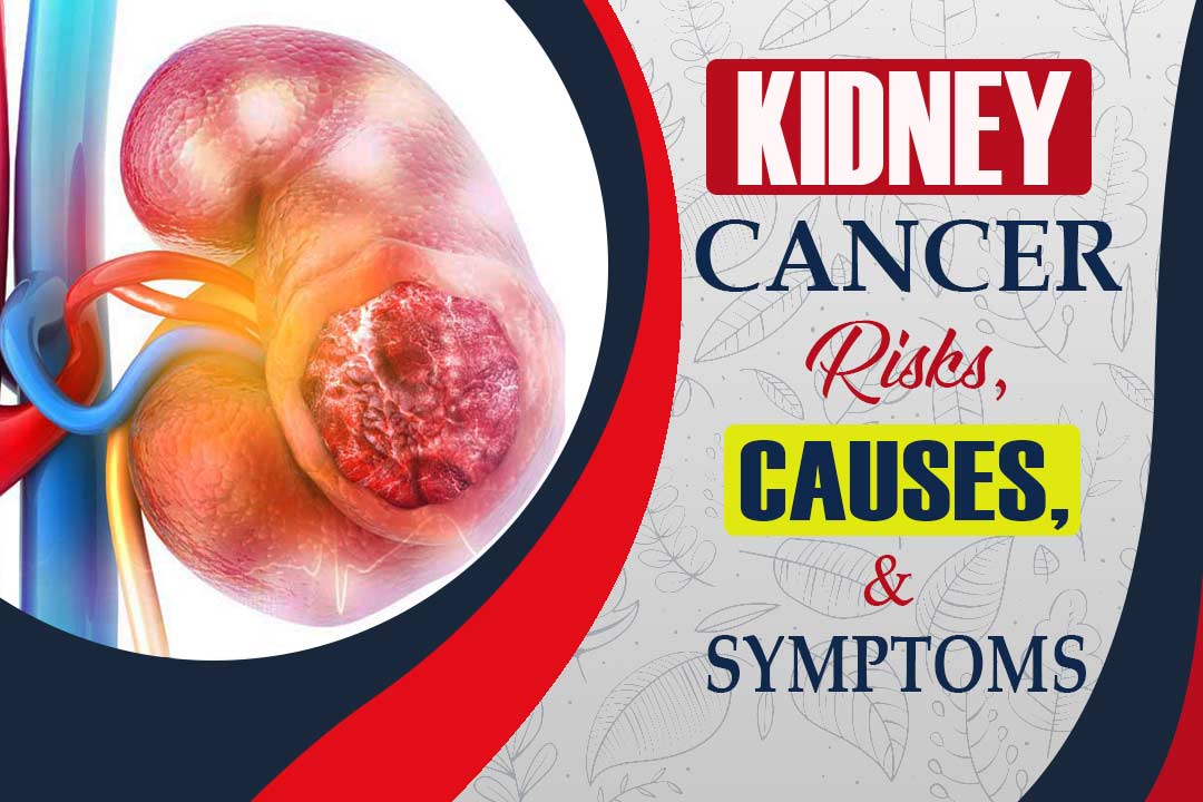 Kidney Cancer is Your Worst Enemy See How to Defeat it