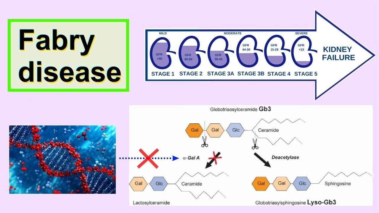 Understanding the Epidemiology of Fabry Disease