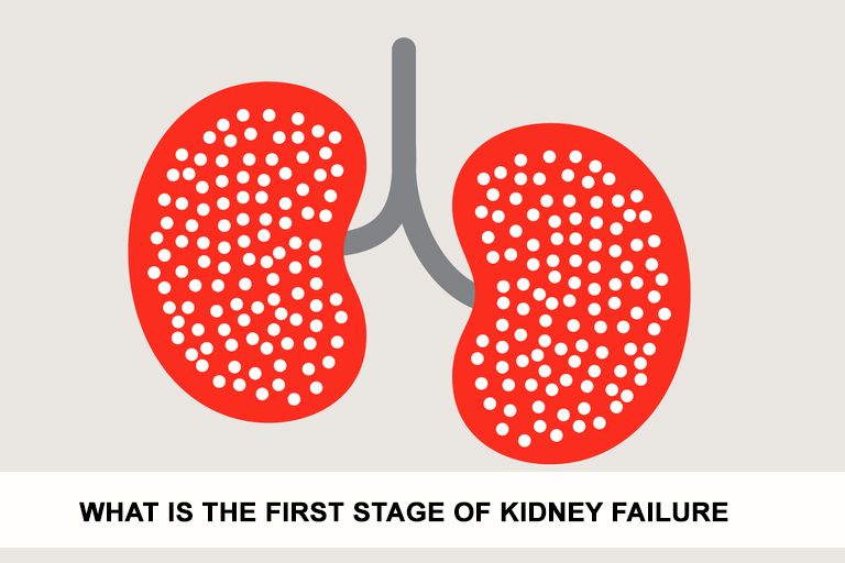 What is the First Stage of Kidney Failure?