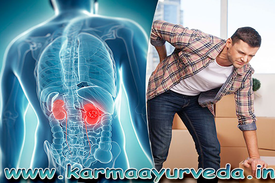 common post renal causes
