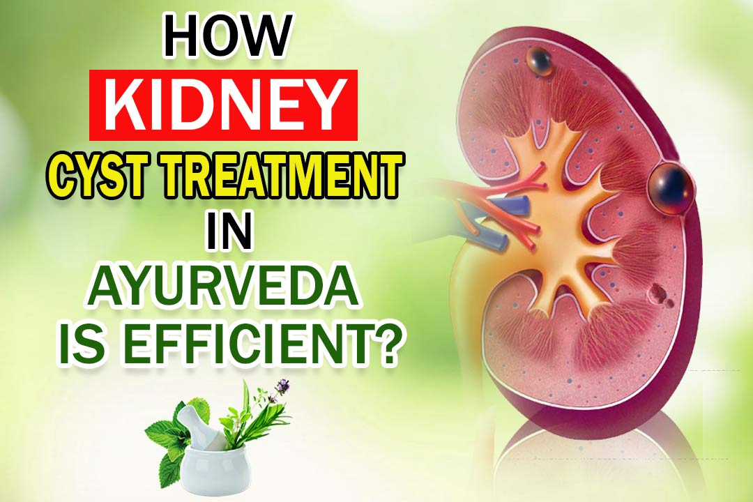 Kidney Cyst Treatment In Ayurveda