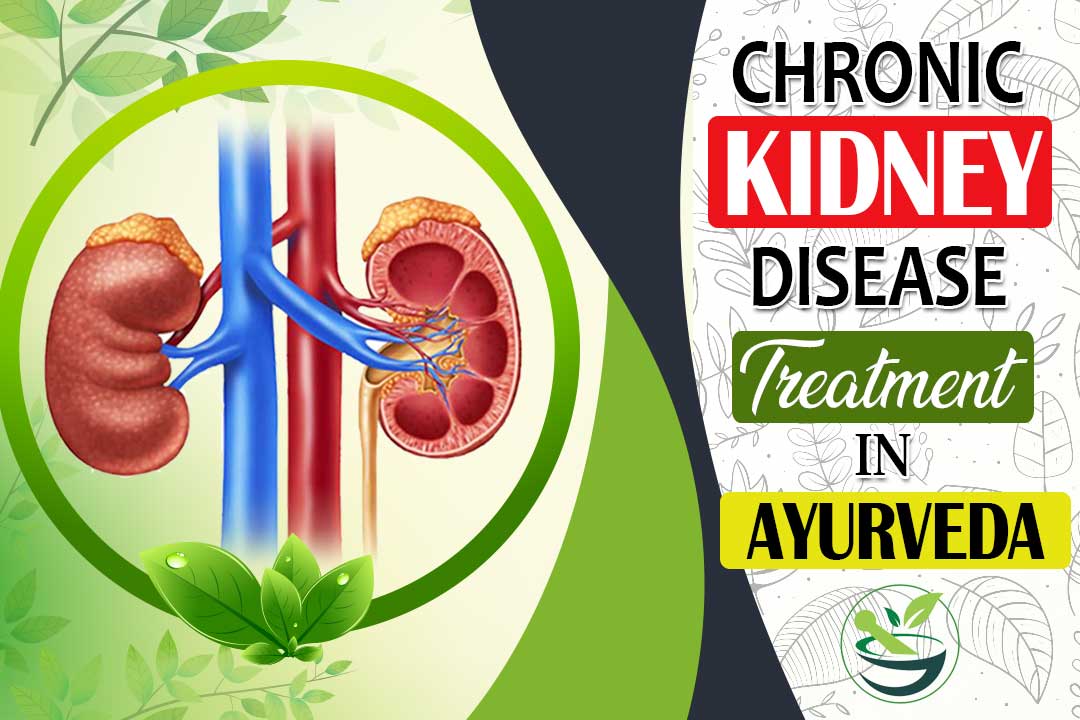 Chronic-Kidney-Disease-Treatment-In-Ayurveda