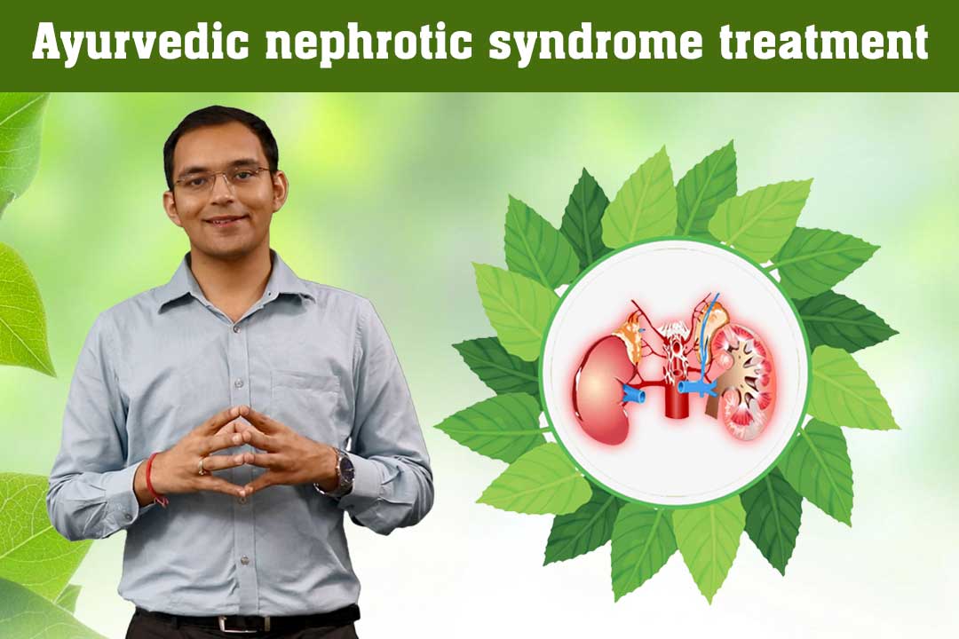 Best Nephrotic Syndrome Treatment in Ayurveda Karma Ayurveda