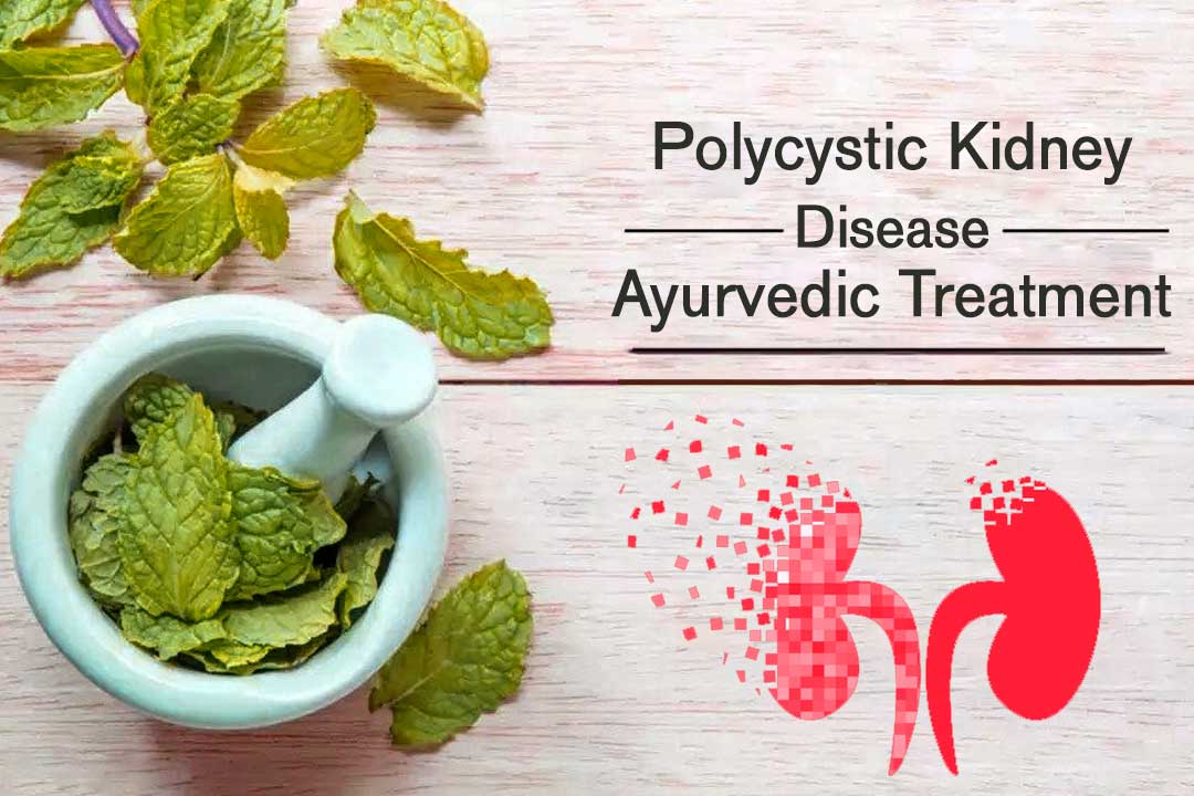 Ayurveda polycystic kidney disease treatment