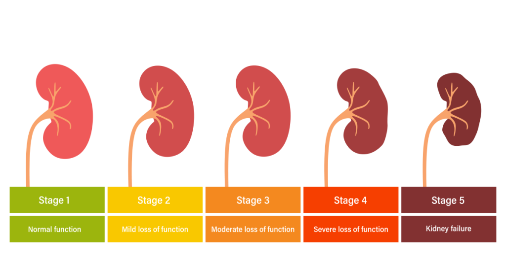 Shrink Kidney Cysts