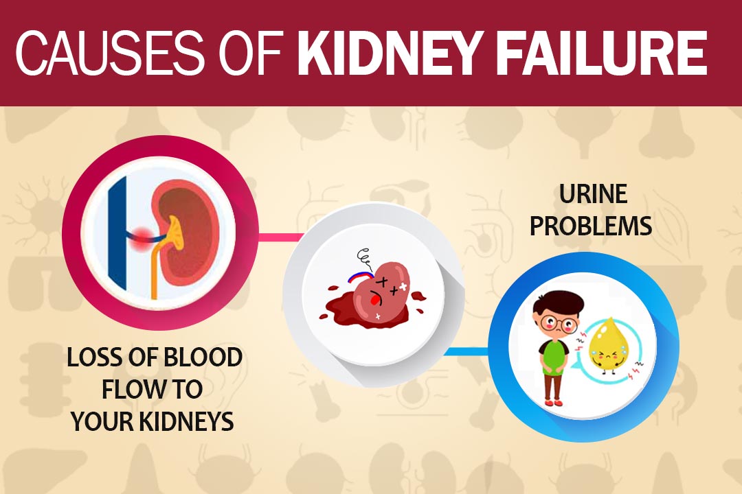 Causes-of-kidney-failure