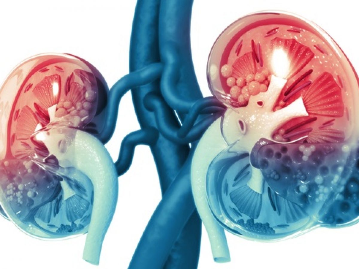 kidney-disease