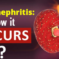 pyelonephritis treatment