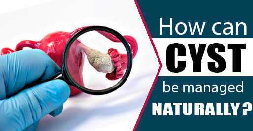 How can cyst be managed naturally