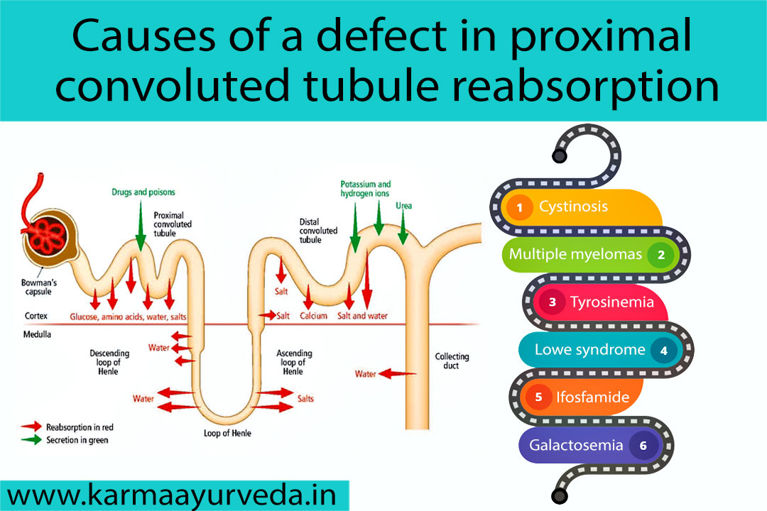 Proximal Convoluted Tubule Reabsorption Kidney Disease