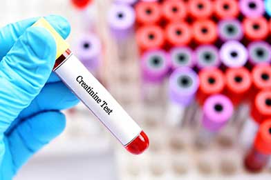 Creatinine Kidney Disease Treatment by Karma Ayurveda