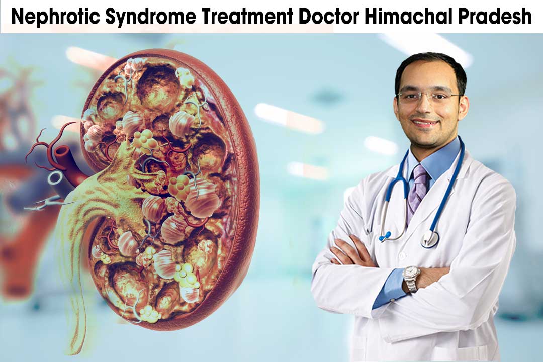 nephrotic syndrome treatment doctor himachal pradesh