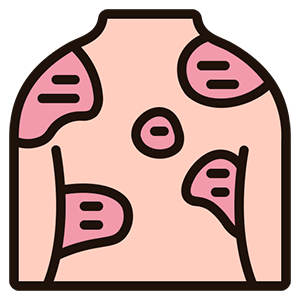 kidney
